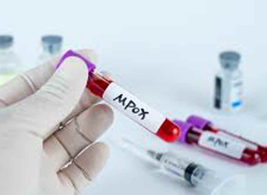 descartan-riesgo-de-epidemia-tras-primer-caso-en-francia-de-mpox-1b